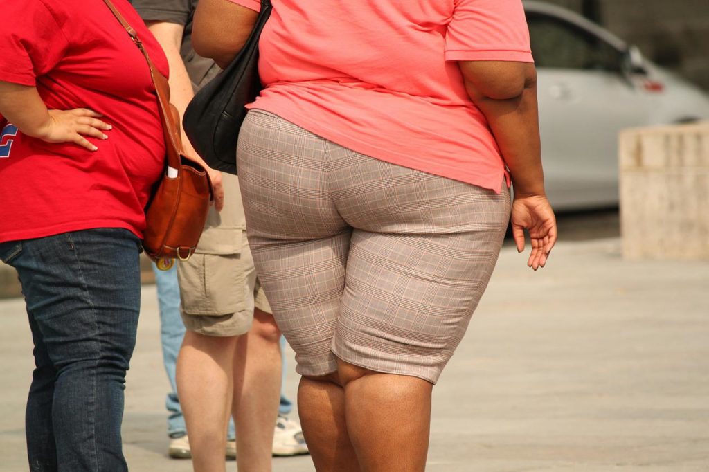 thick, overweight, obesity-373064.jpg